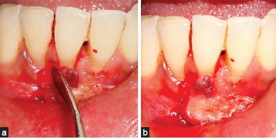 Figure 19