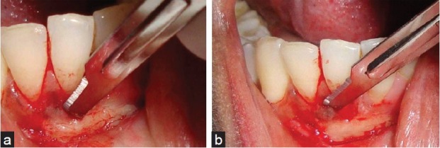 Figure 15