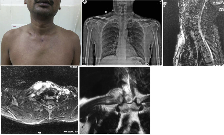 Fig. 1