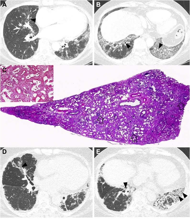 Fig. 2