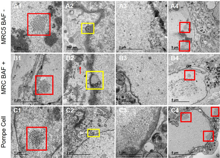FIG 4