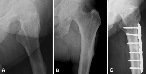 Fig. 1A–C