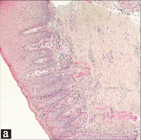 Figure 2a