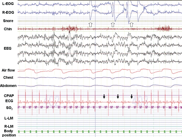 Figure 1b