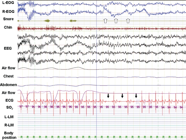 Figure 1a