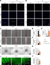 Figure 4—figure supplement 2.