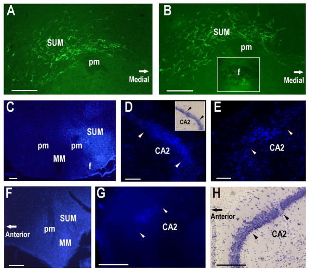 Fig. 13