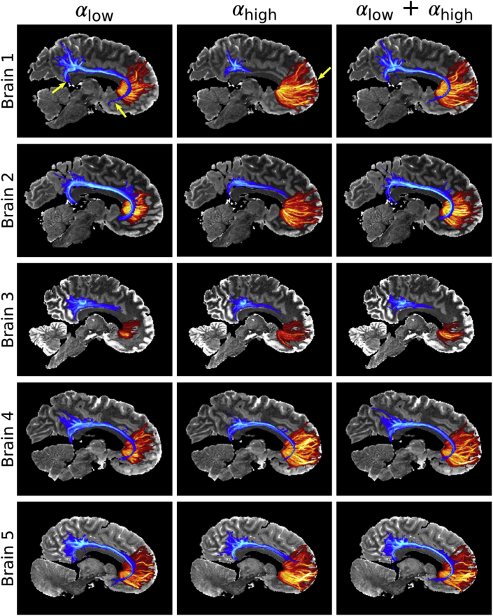 Fig. 11