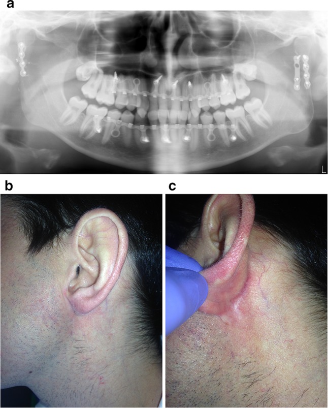 Fig. 3