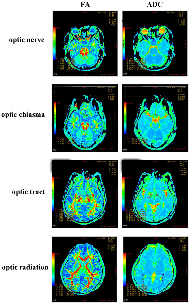 FIGURE 2