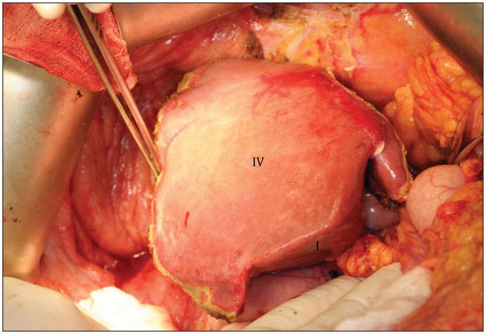 Figure 4: