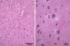 Fig. 18