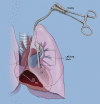 Figure 2: