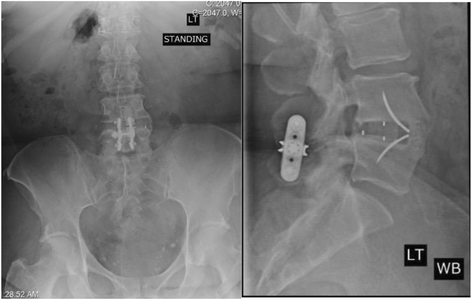 Fig. 4