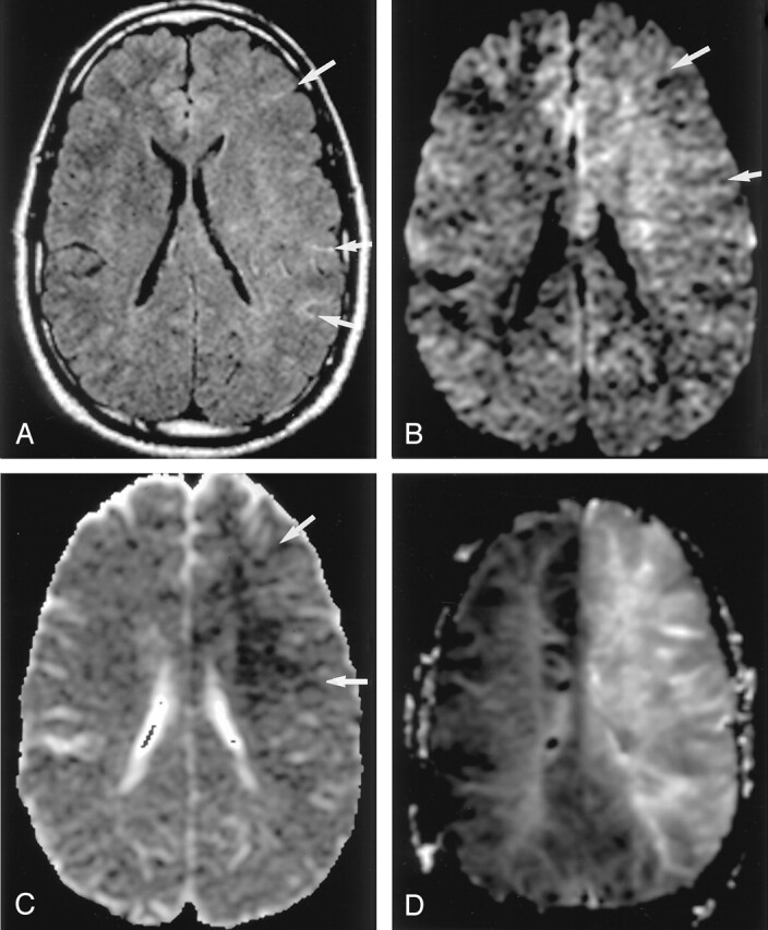 Fig 3.