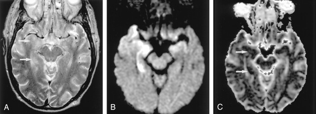 Fig 10.