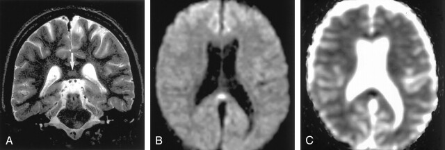 Fig 13.