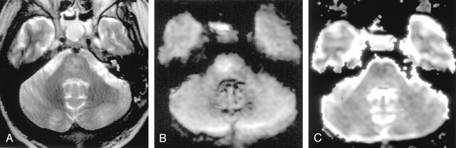 Fig 14.