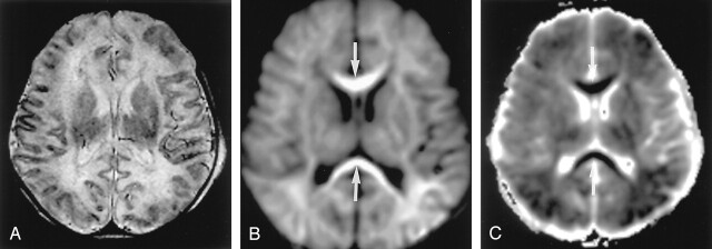 Fig 5.