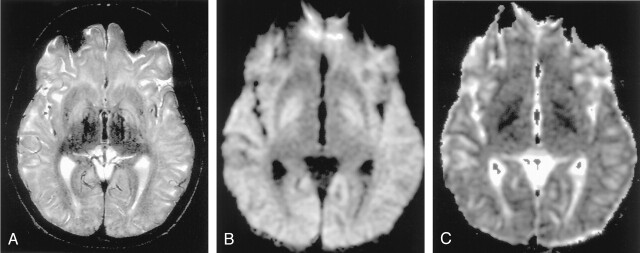 Fig 17.