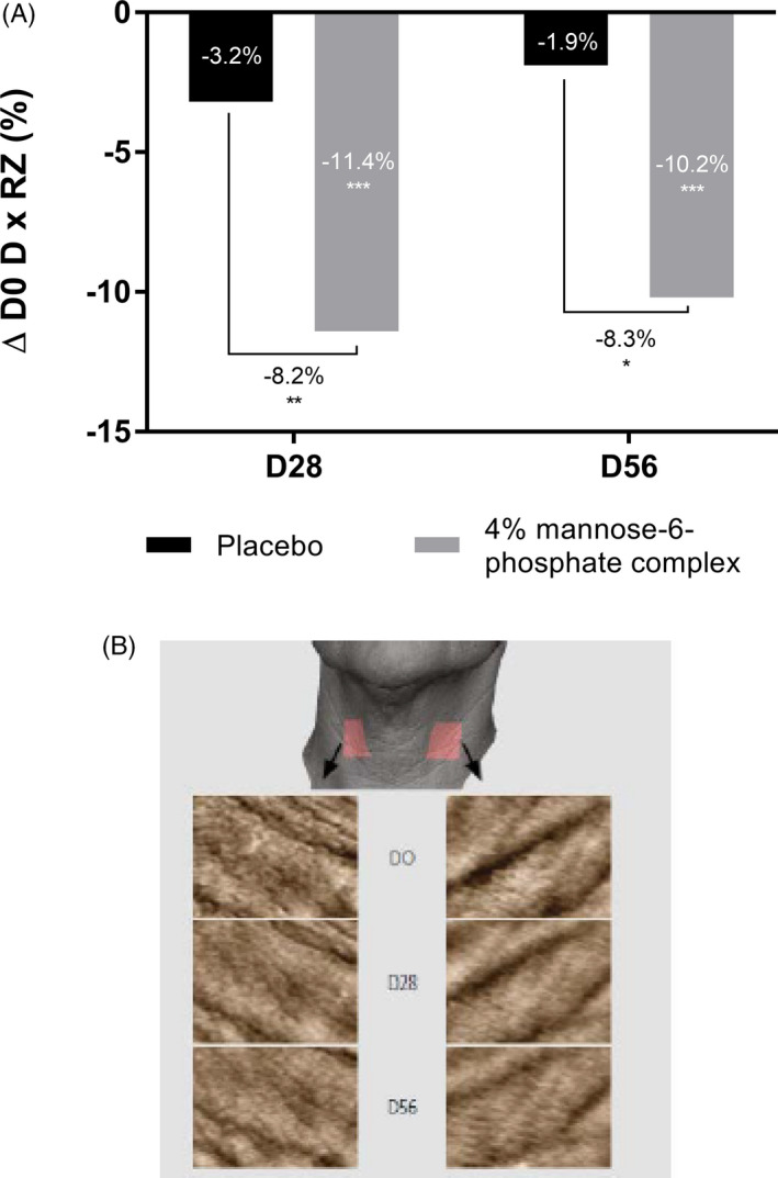 FIGURE 11