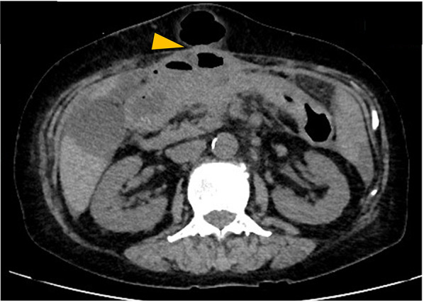 Fig. 8