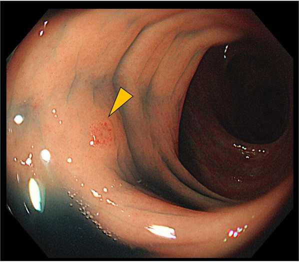 Fig. 7