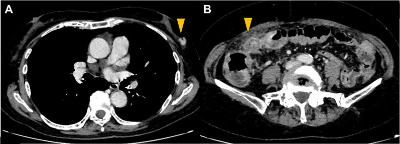 Fig. 5