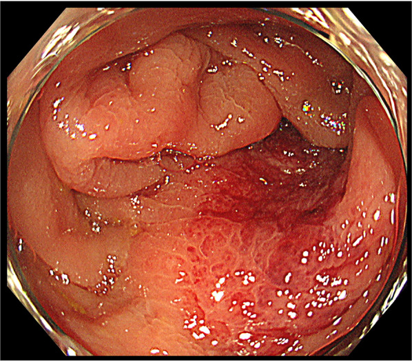 Fig. 6