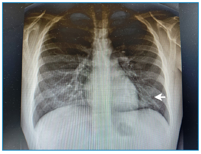 FIGURE 2: