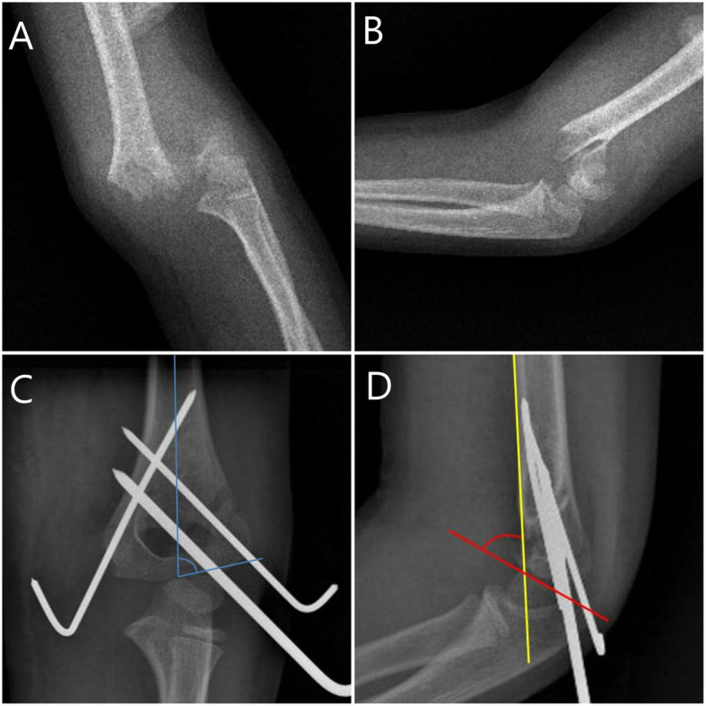 Fig. 1