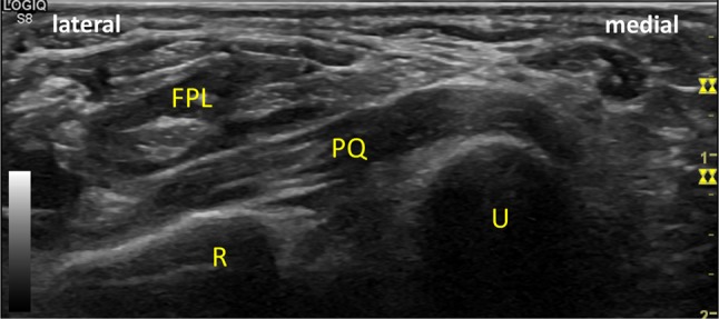 Fig. 5