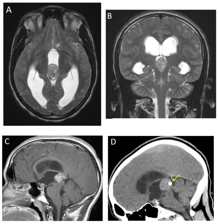 Figure 12