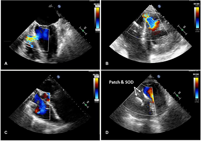 Figure 2