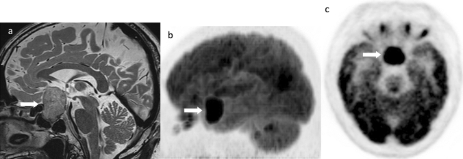 Fig. 10