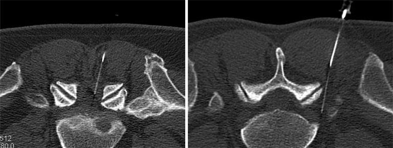 Fig. (2)