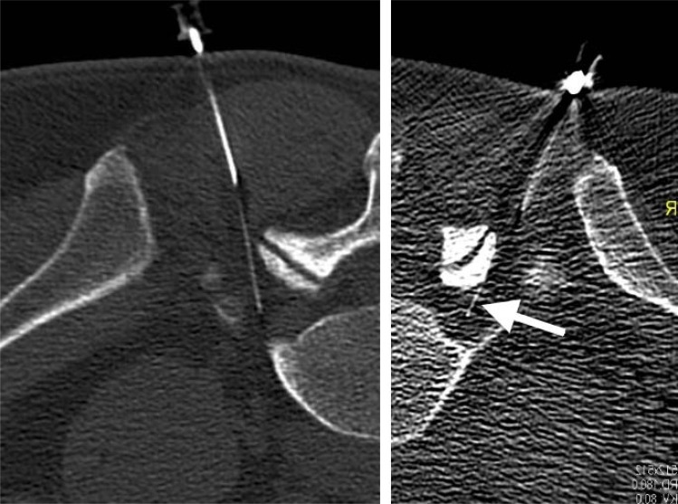 Fig. (3)