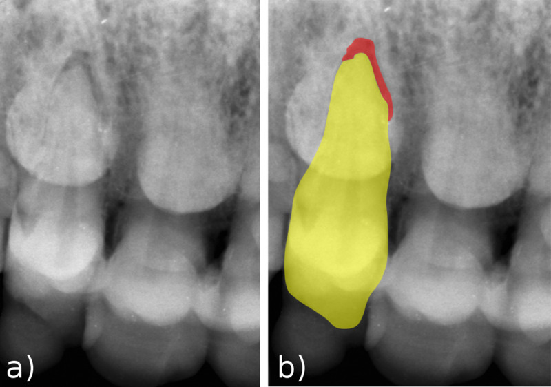Fig 10