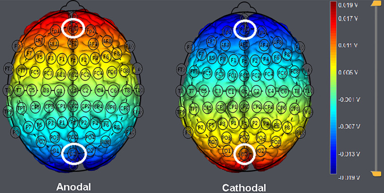 FIGURE 3