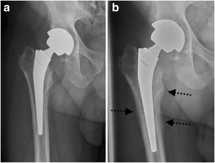 Fig. 17