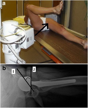 Fig. 13