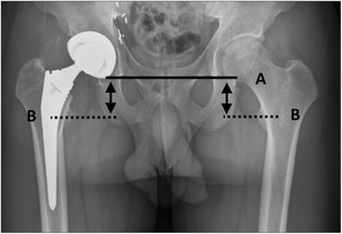 Fig. 9