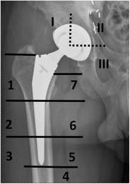 Fig. 14