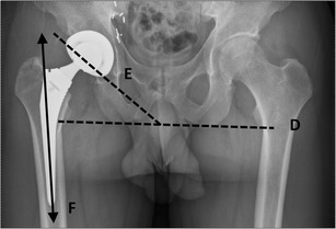 Fig. 11