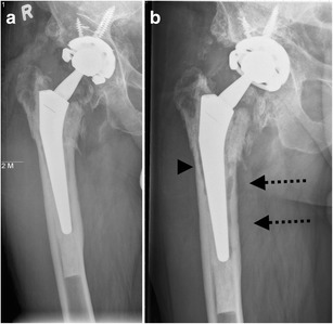 Fig. 18