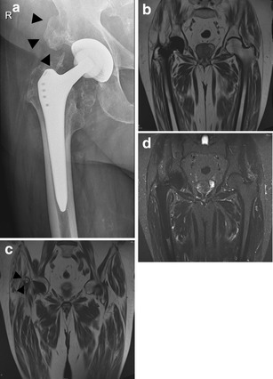 Fig. 20