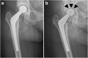 Fig. 25