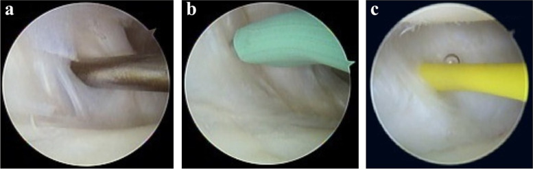 Fig. 2