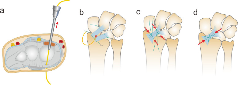 Fig. 5