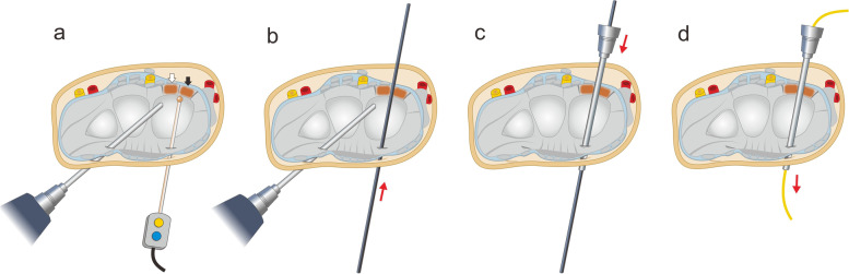 Fig. 3